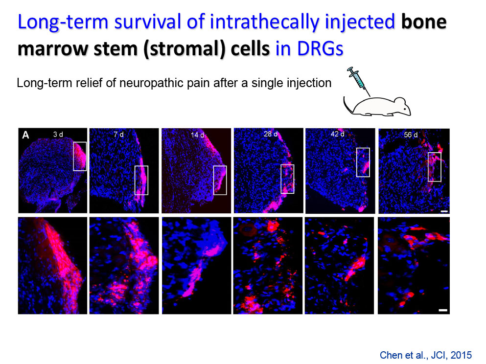 Long-term survival of intrathecally injected bone marrow stem (stromal) cells in DRGS