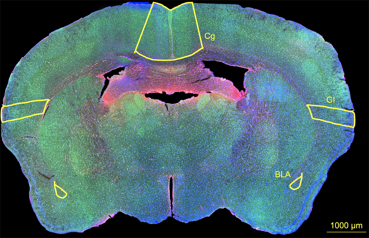 10x widefield representative image outlining the investigated brain regions