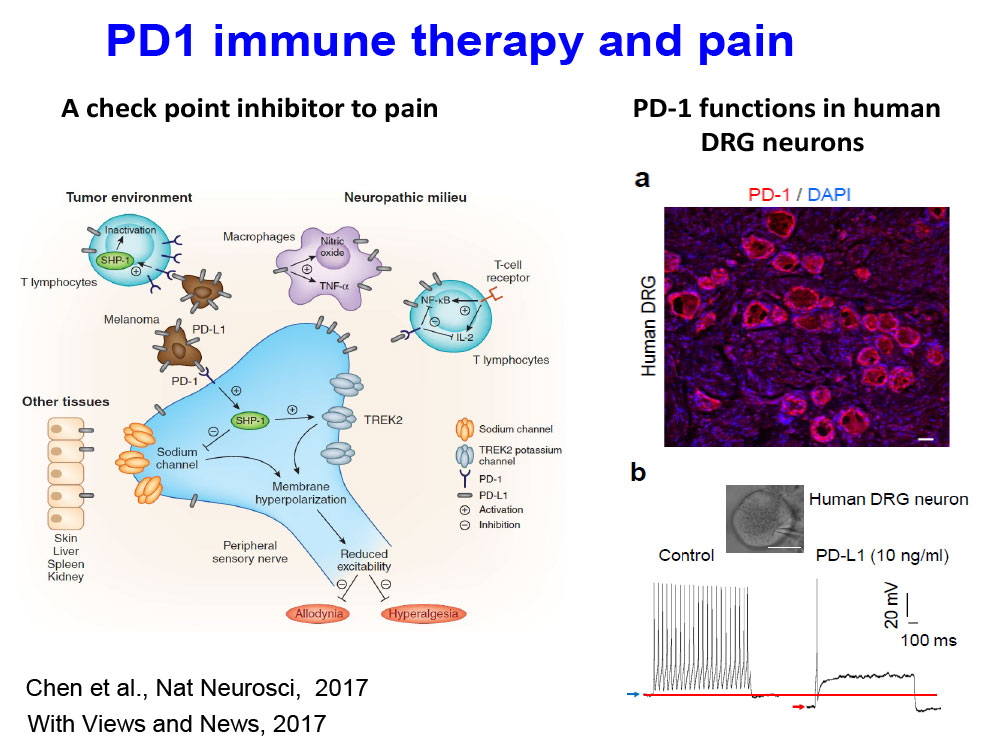 PD1 immune therapy and pain