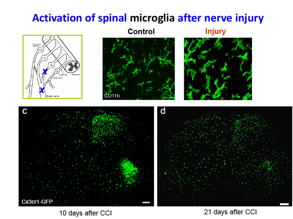Activation of spinal microglia after nerve injury