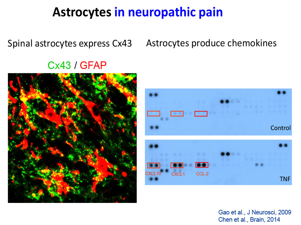 Astrocytes in neuropathic pain