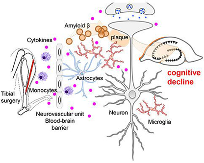 Neurovascular Dysfunction in Delirium Superimposed on Dementia
