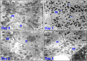 Lung cells under microscope for study.