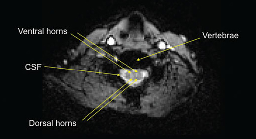 Axial view of an example human cervical spine functional MRI image.
