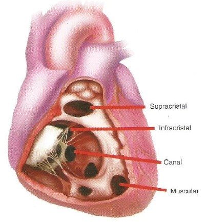 Section of heart showing internal parts