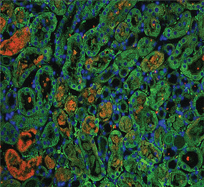 Kidney Tubular Cells