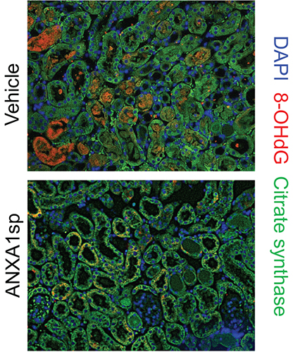 FIGURE 1: ANXA1sp-treated mice have lower levels of oxidative stress as measured by 8-OHdG staining (red) in kidney tissue sections.