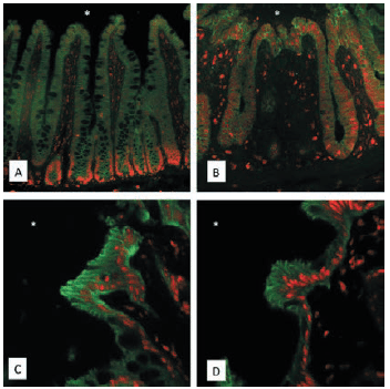 Figure 1: Colonic SUMO expression in a rat model of deep hypothermic circulatory arrest (DHCA). Immunofluorescence change of SUMO2/3 distribution from exclusively basal expression in Sham (A) to broad-spread epithelial in DHCA treated animals (B). In contrast, SUMO1 staining does not change between Sham (C) and DHCA treated animals (D). Magnification 400x, Red: Sumo, Green: E-cadherin (intestinal epithelial marker). Asterisks denote intestinal luminal side.