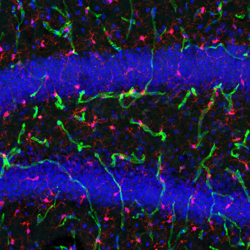 Immunovascular interactions in the brain after surgery (red: microglia cells; green: endothelial cells; blue: nuclei). Photo courtesy: the Terrando lab.