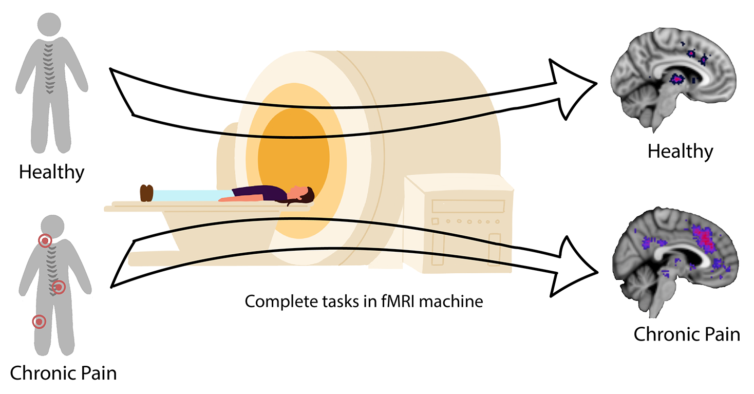 Schematic image of research participants and an MRI scanner. Brain images showing group differences for illustrative purposes only. Created by K. Martucci & Carina Lei 2023.