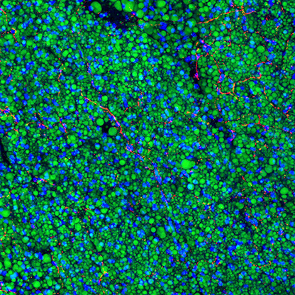 Mouse BAT IHC: Tyrosine hydroxylase /DAPI/Bodipy