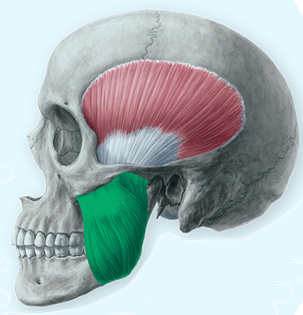 TMD can be categorized as arthralgia (affecting the joint) or as myalgia (affecting the muscles of mastication). Contraction of the masseter muscle, shown in green, raises the mandible closing the mouth during chewing or speaking. It is innervated by the masseteric nerve, a branch of the trigeminal nerve. Other muscles that may be painful or tender in TMD include the temporalis muscle and the medial and lateral pterygoid muscles, also shown.