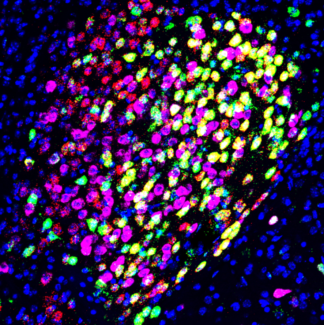 General anesthesia induced neuronal activation in the central amygdala.