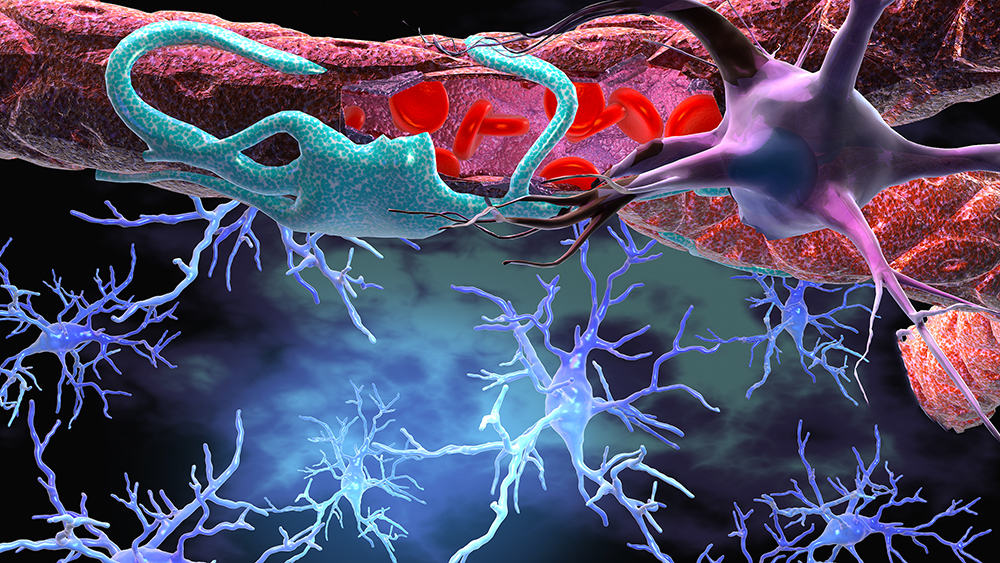 perioperative neurocognitive disorders