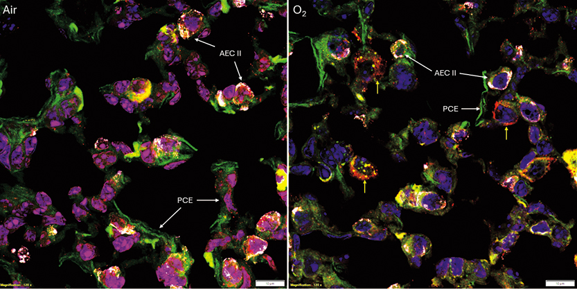 FIGURE 2. Mitophagy in a murine model of experimental lung injury.